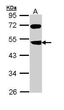 FBXL3 Rabbit Polyclonal Antibody