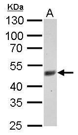 FBXL3 Rabbit Polyclonal Antibody