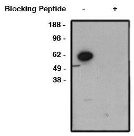 Rabbit anti Human FBXW7 Antibody