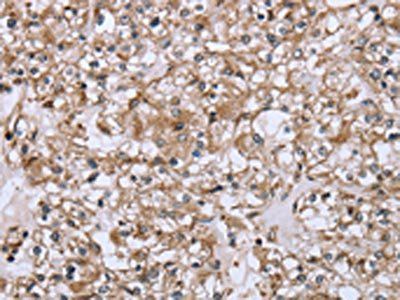 FCAR Antibody