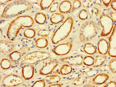 FCGR2A Antibody