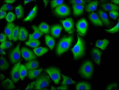 FCGR3B Antibody