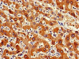 FDPS Antibody