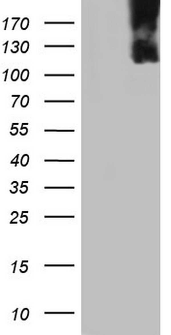 FEN1 Antibody