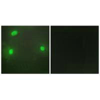 FEN1 Antibody