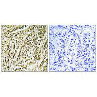 FEN1 Antibody