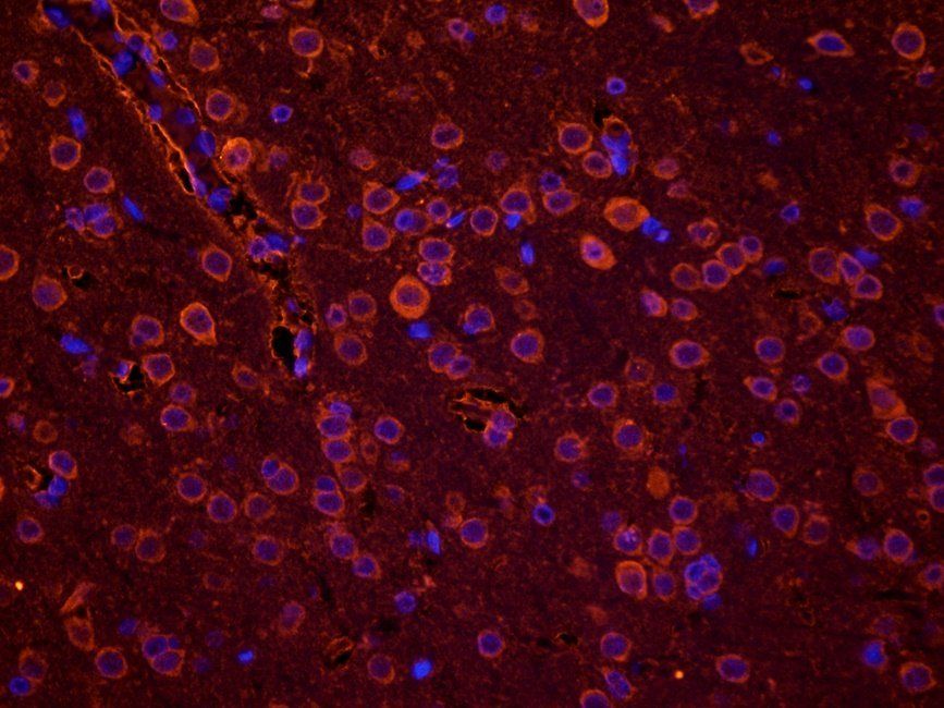 Ferritin Rabbit Polyclonal Antibody