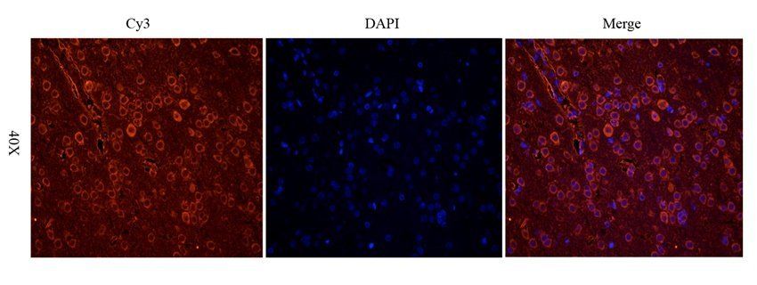 Ferritin Rabbit Polyclonal Antibody