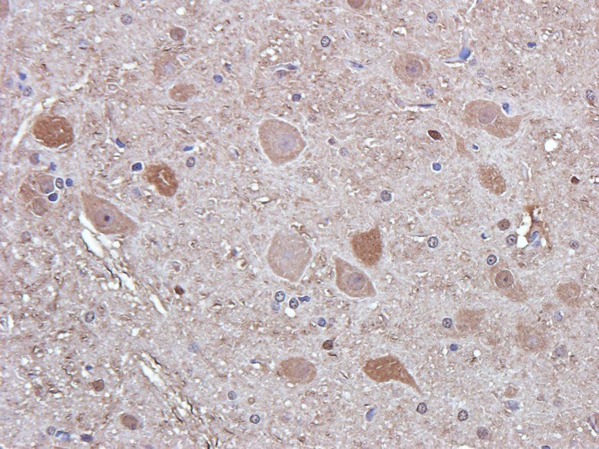 Ferritin Rabbit Polyclonal Antibody