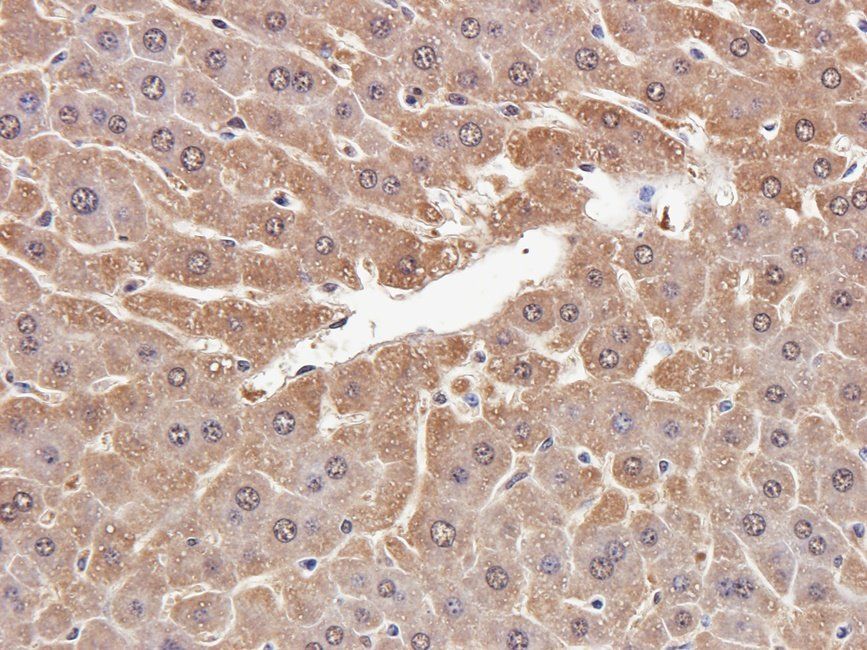Ferritin Rabbit Polyclonal Antibody