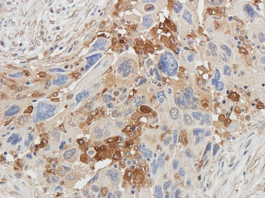 Ferritin Rabbit Polyclonal Antibody