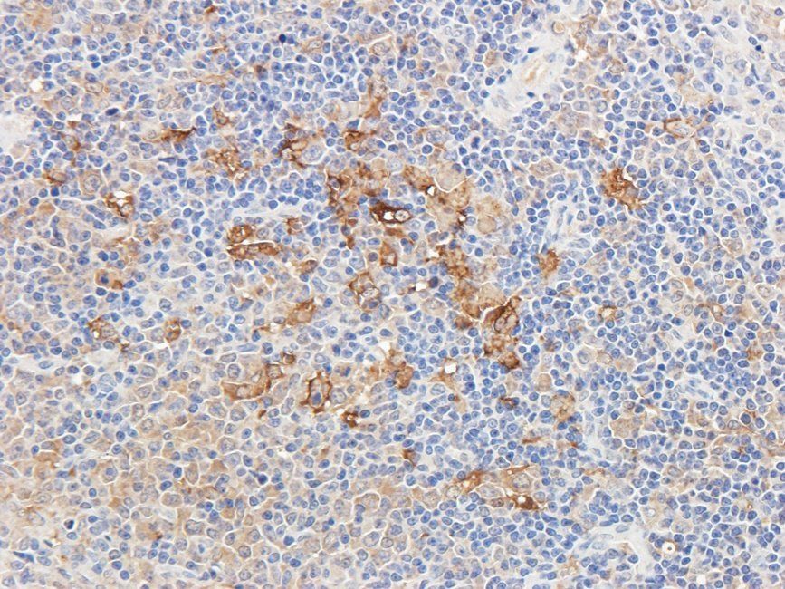 Ferritin Rabbit Polyclonal Antibody