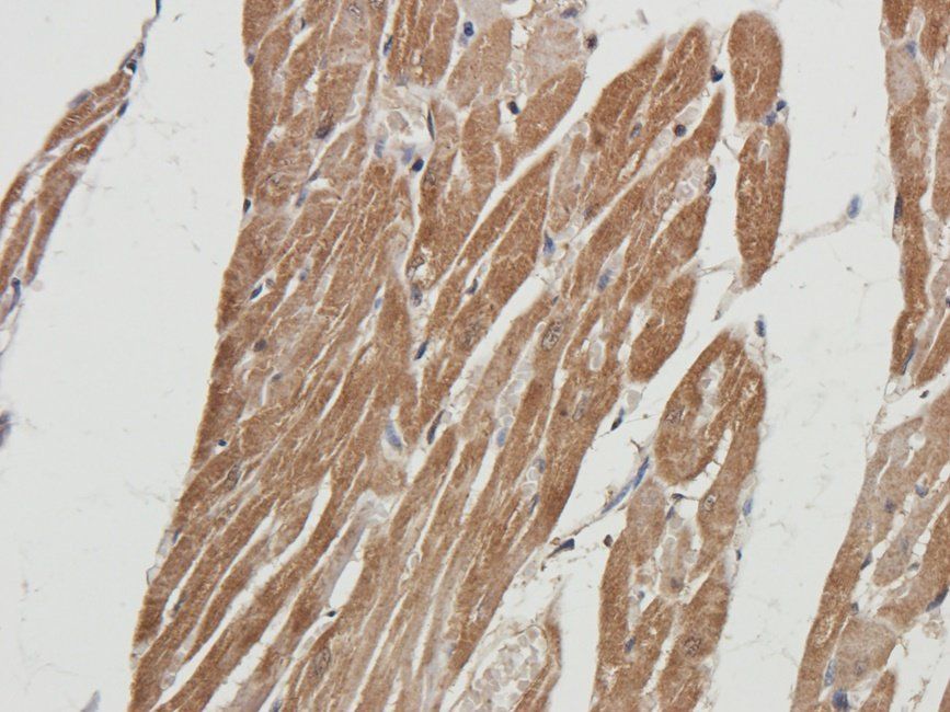 Ferritin Rabbit Polyclonal Antibody