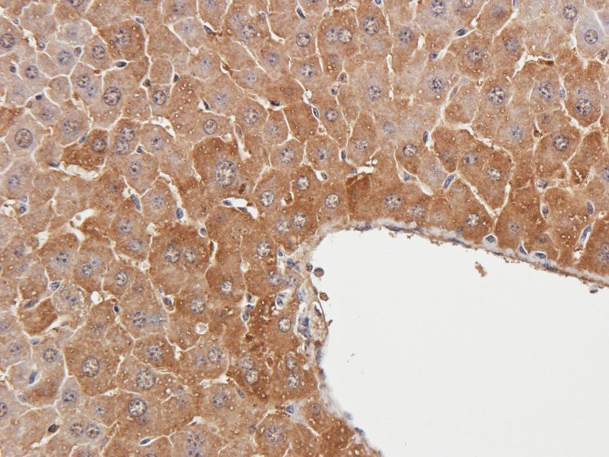 Ferritin Rabbit Polyclonal Antibody