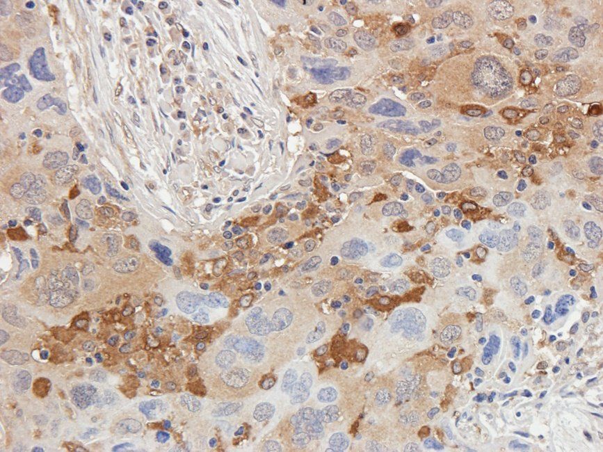 Ferritin Rabbit Polyclonal Antibody