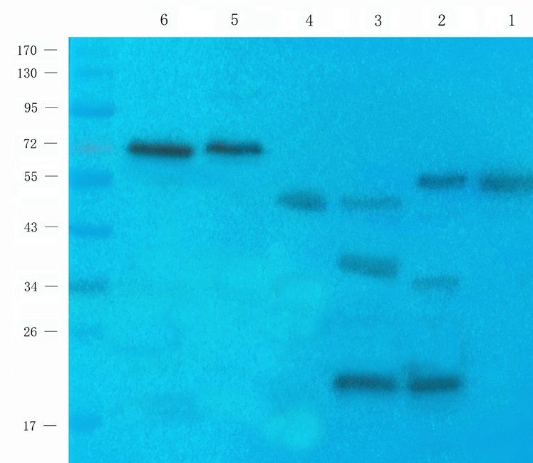 Ferritin Rabbit Polyclonal Antibody