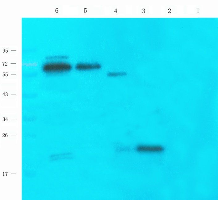 Ferritin Rabbit Polyclonal Antibody