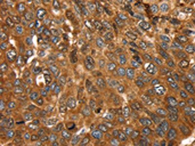 FTH1 Antibody