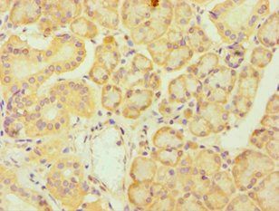FES Antibody