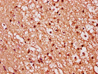 FGF1 Antibody