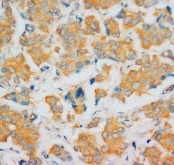 Fibroblast growth factor 4 FGF4 Rabbit Polyclonal Antibody