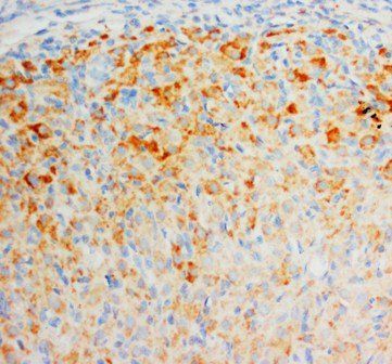 Fibroblast growth factor 8 FGF8 Rabbit Polyclonal Antibody