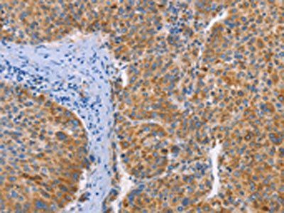 FGL1 Antibody