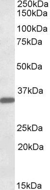 FGL1/Hepassocin Antibody