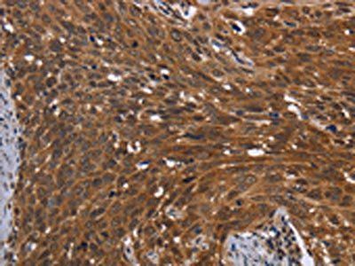 FHIT Antibody