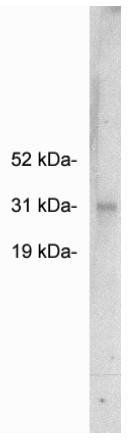 Rabbit anti Human FHL2 Antibody