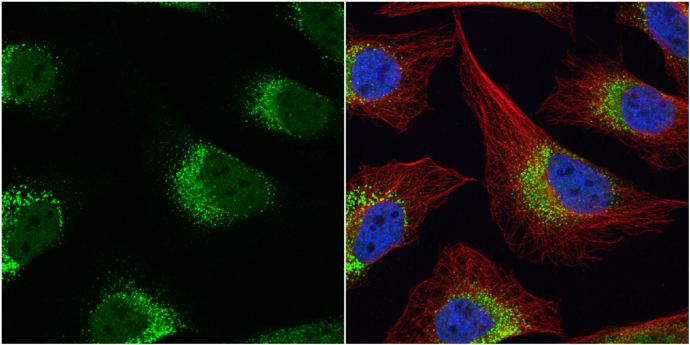 Fibrinogen gamma Rabbit Polyclonal Antibody