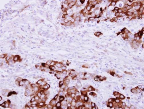 Fibrinogen gamma Rabbit Polyclonal Antibody
