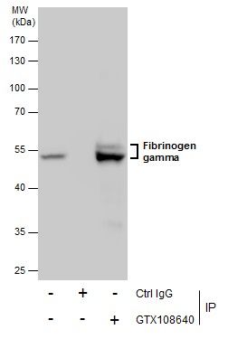 Fibrinogen gamma Rabbit Polyclonal Antibody