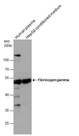 Fibrinogen gamma Rabbit Polyclonal Antibody