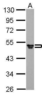 Fibrinogen gamma Rabbit Polyclonal Antibody