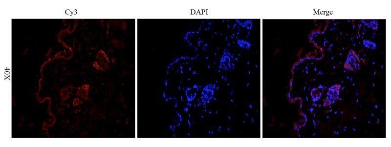 Fibrinopeptide B Rabbit Polyclonal Antibody