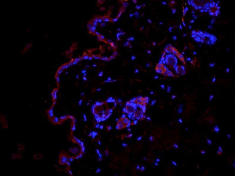 Fibrinopeptide B Rabbit Polyclonal Antibody