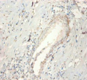 FGF21 Antibody