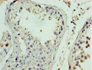 FANK1 Antibody
