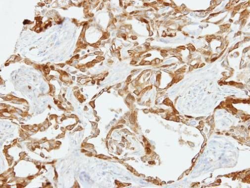 LOXL2 Rabbit Polyclonal Antibody