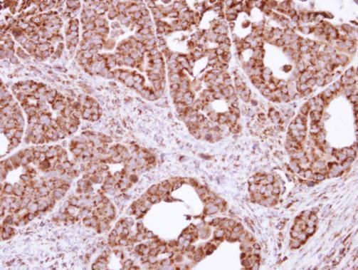 FIS1 Rabbit Polyclonal Antibody