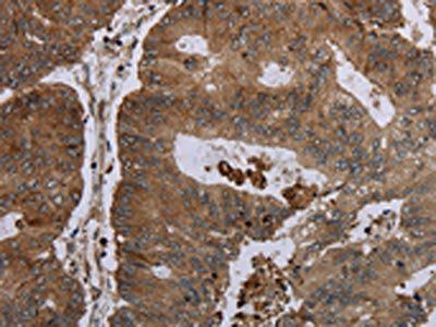 FOLH1B Antibody