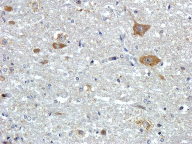 FOLR2 Rabbit Polyclonal Antibody