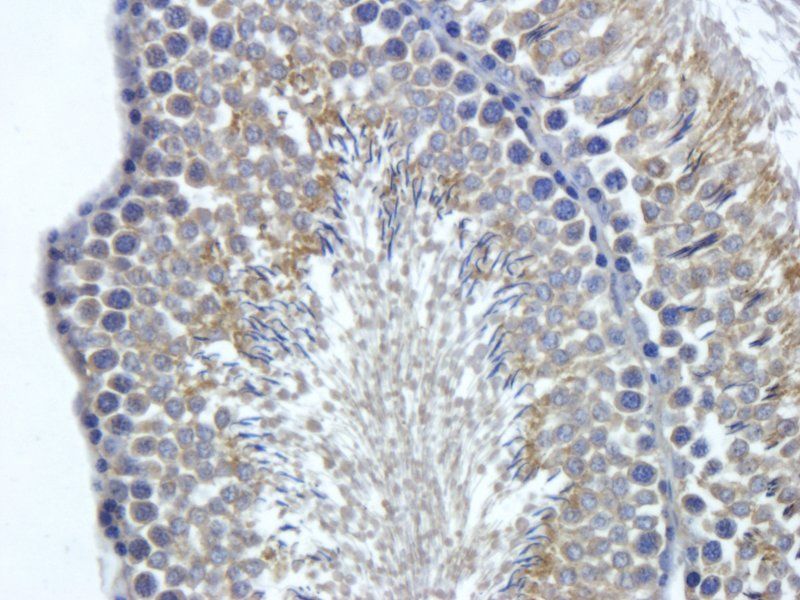 FOLR2 Rabbit Polyclonal Antibody