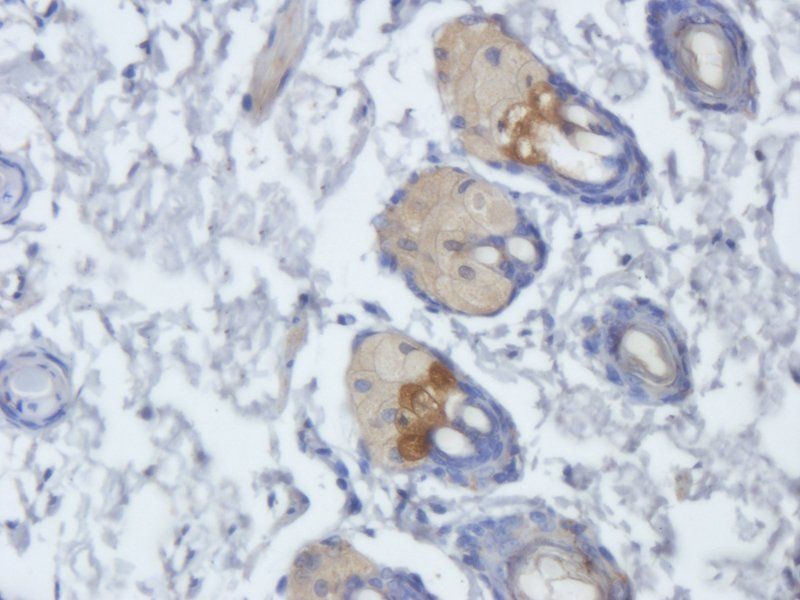 FOLR2 Rabbit Polyclonal Antibody