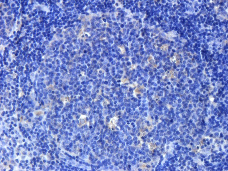 FOLR2 Rabbit Polyclonal Antibody
