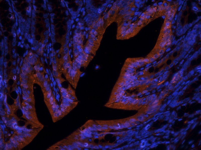 FOLR2 Rabbit Polyclonal Antibody