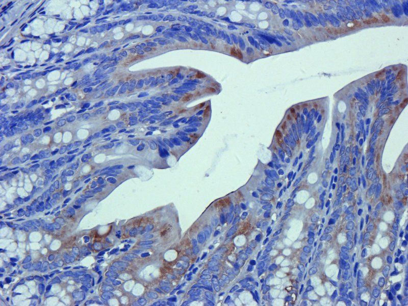 FOLR2 Rabbit Polyclonal Antibody