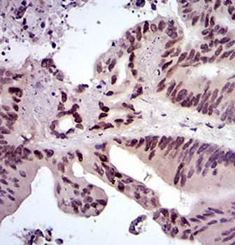 FOS Antibody