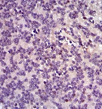 FOS Antibody